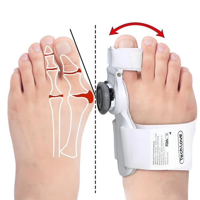Say Goodbye to Bunion Pain with the Best Big Toe Corrector Splint - Gear Elevation
