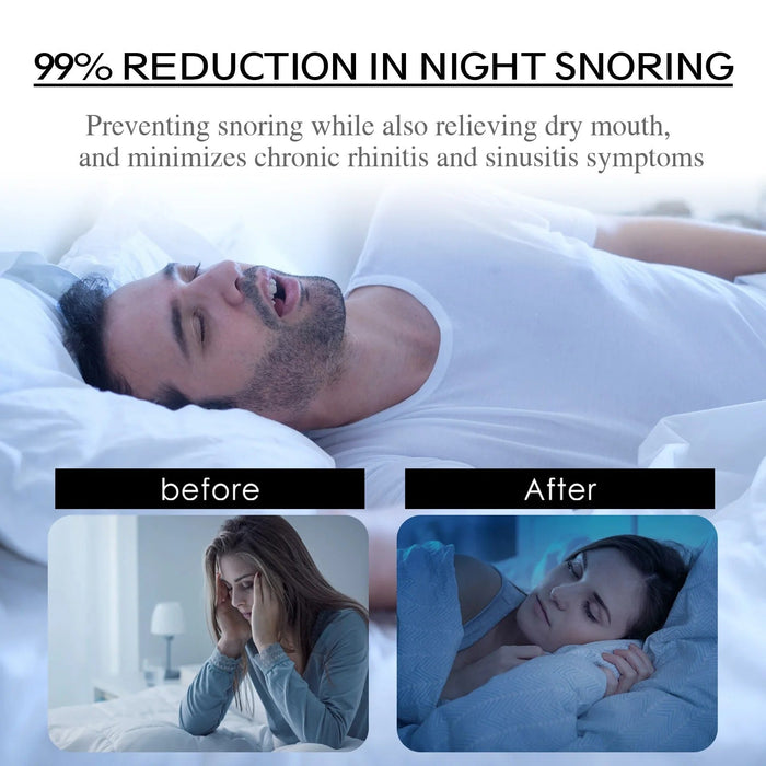 Anti-Snoring Patch Nose Breathing Correction - Mouth Orthosis Tape for Better Sleep - Works Instantly to Remove Snoring, for Men and Women - Gear Elevation