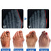 Anti - Bunion and Vein Heal Health Socks - Health Sock Bunion Relief Socks Corrector Ortho for Women & Men - Gear Elevation