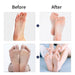 Electric Feet Callus Remover - Gear Elevation