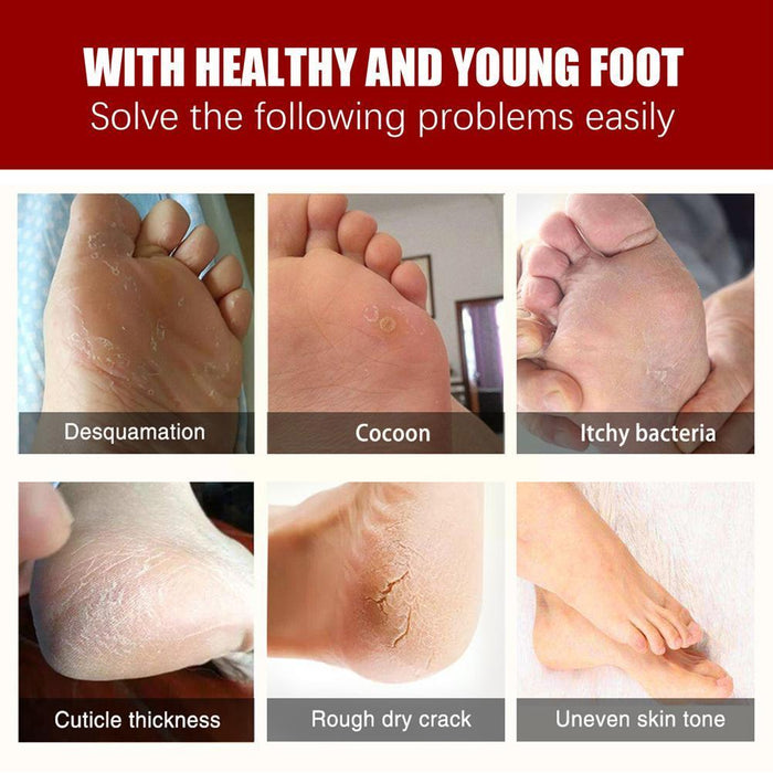 Exfoliating Foot Mask - Unlock the Secret to Soft, Beautiful Feet - Gear Elevation