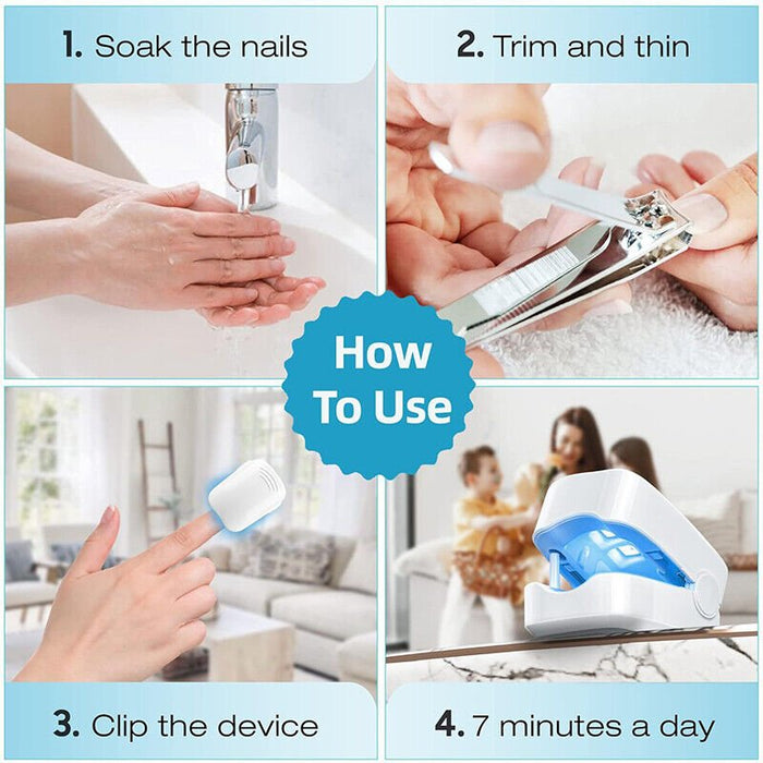 Nail Fungus Cleaning Laser Device - Expert Revolutionary High-Efficiency Light Therapy Device For Toenail Diseases - Gear Elevation