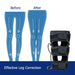 O/X Type Bow Leg Correction Brace - Band Belt Bowed Knee Straightening Beauty Leg Band For Adults - Gear Elevation
