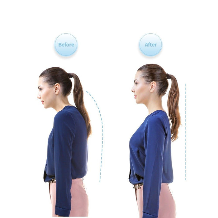 Smart Posture Corrector - Neck Hump Straightener Improve Your Posture for Adult and Kid - Gear Elevation